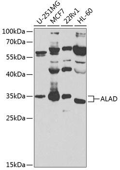 ALAD Antibody