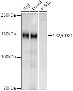 CD21 Antibody