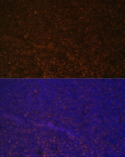 CD21 Antibody
