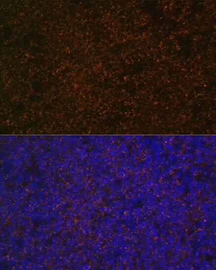 CD21 Antibody