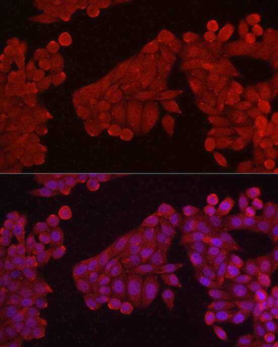 Hexokinase Type III Antibody