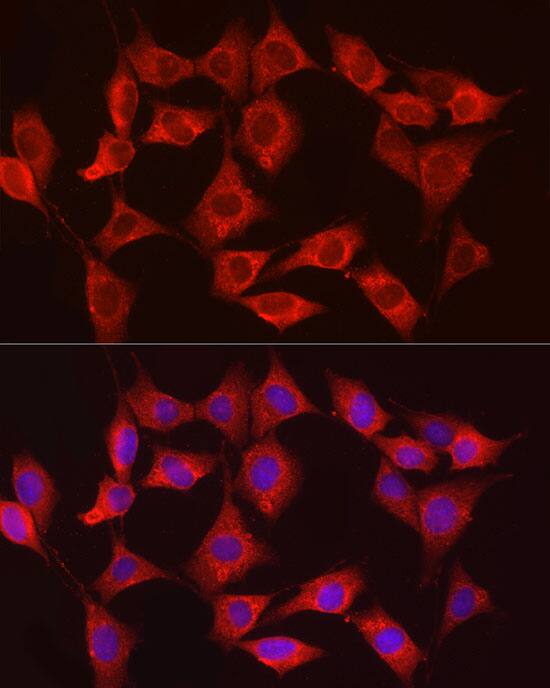 Hexokinase Type III Antibody
