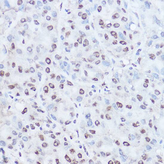 TAF15 Antibody