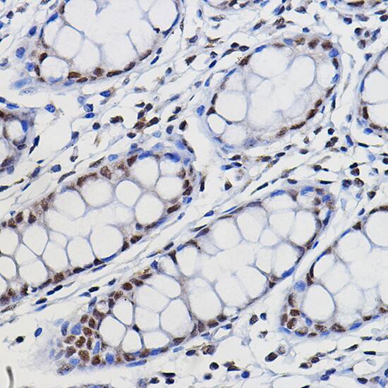 METTL14 Antibody