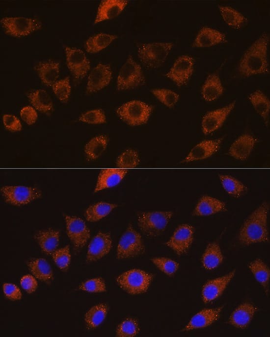 DLG1 Antibody