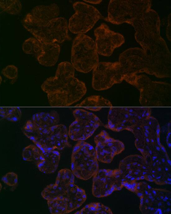 Myosin VB Antibody