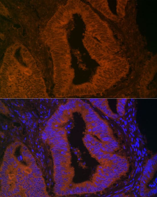 Myosin VB Antibody