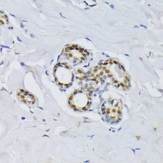 BCCIP Antibody
