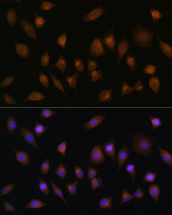 SNX1 Antibody