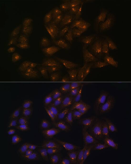SNX1 Antibody