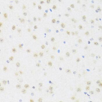 DDX50 Antibody