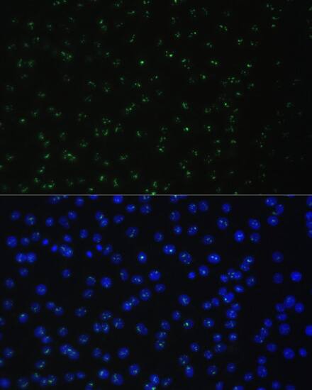 DDX50 Antibody