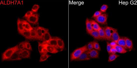 ALDH7A1 Antibody