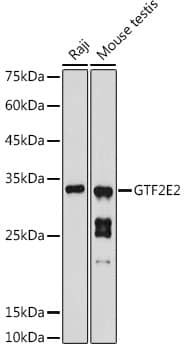 TFIIE beta Antibody