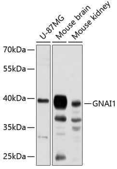 G protein alpha inhibitor 1 Antibody