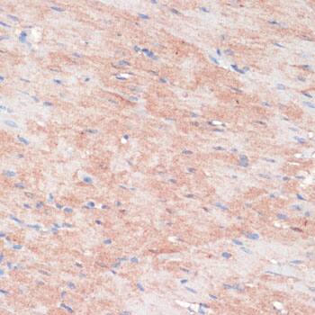 RPIA Antibody