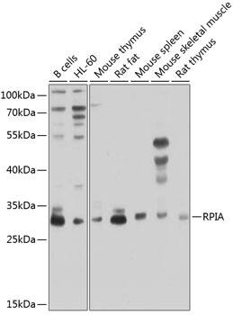 RPIA Antibody