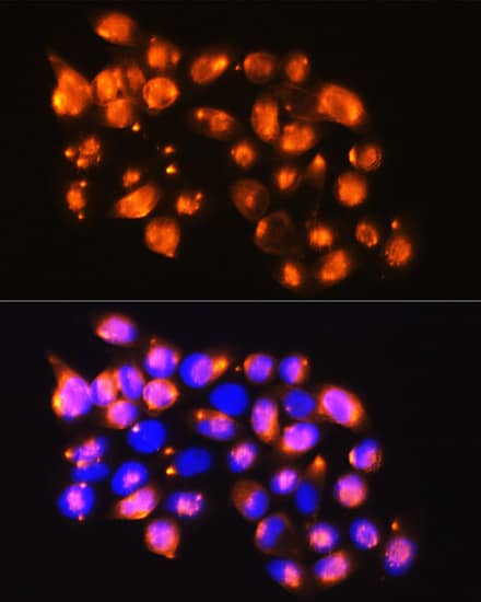 EPB4IL2 Antibody