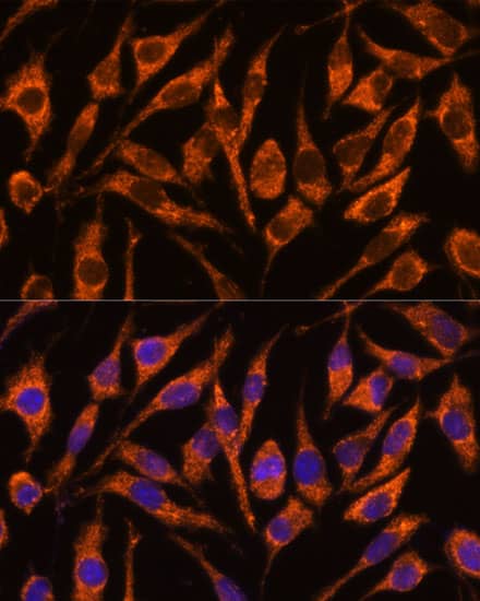 SNX15 Antibody