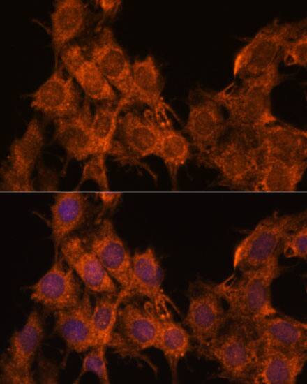 SNX15 Antibody