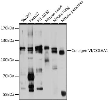 Collagen VI alpha 1 Antibody