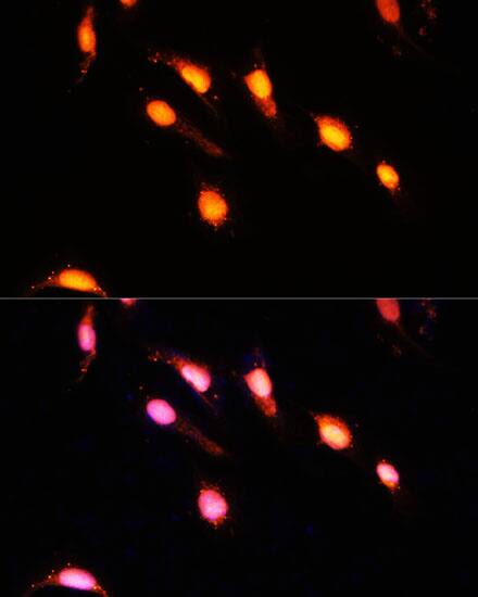 GTF3C4 Antibody