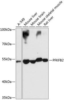 PFKFB2 Antibody