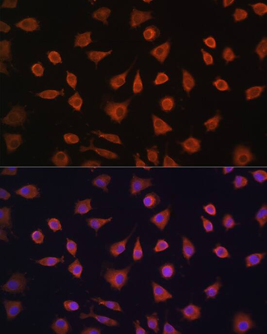 PFKFB2 Antibody