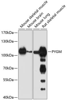 Glycogen phosphorylase, muscle form Antibody