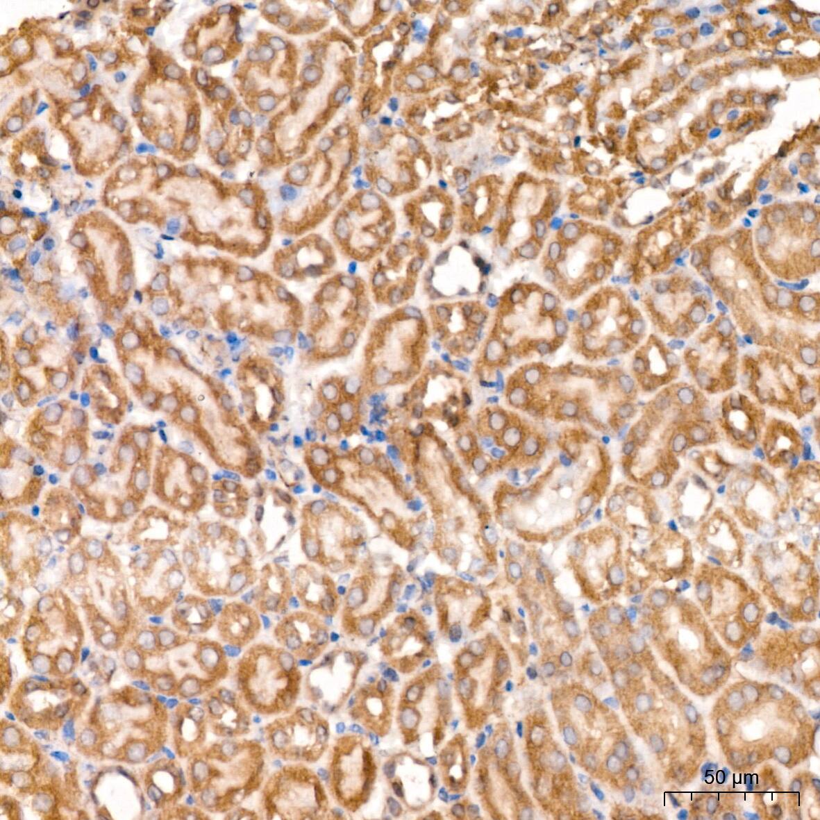 PCCA Antibody