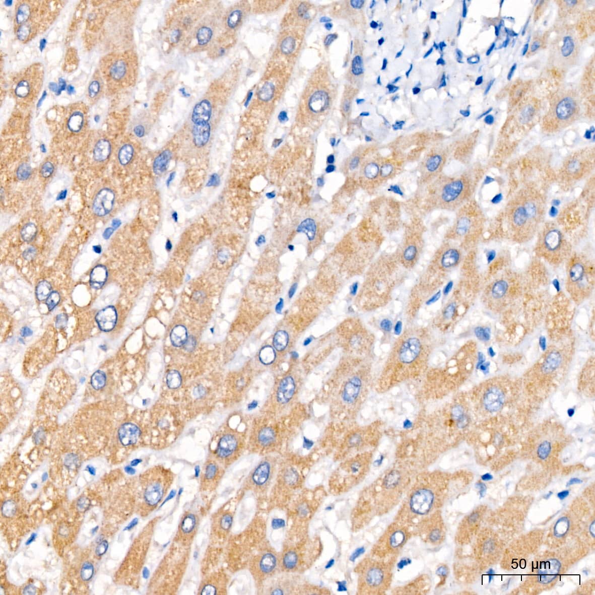 PCCA Antibody
