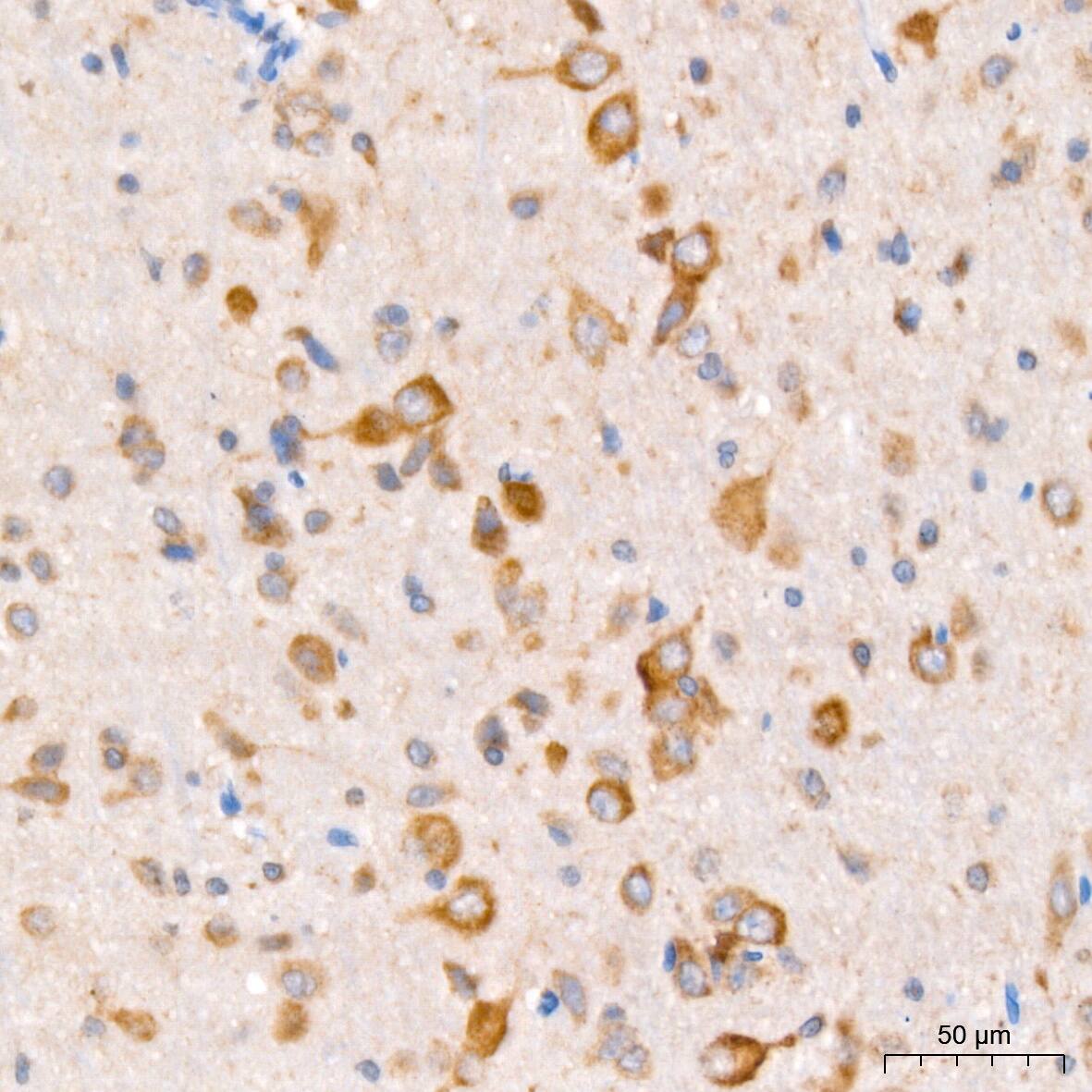 PCCA Antibody