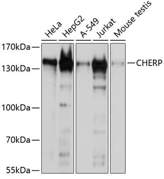 CHERP Antibody