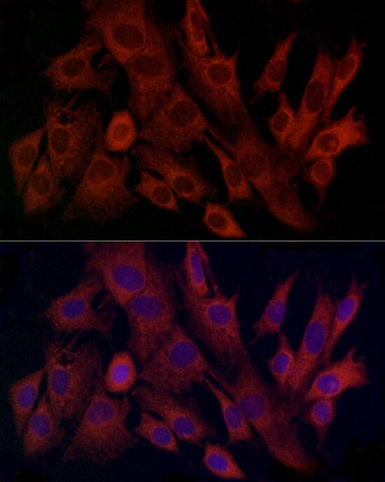 TIMM8A Antibody