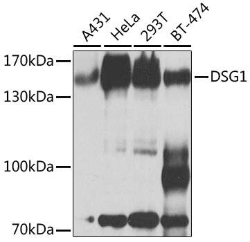 Desmoglein-1 Antibody