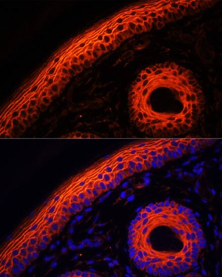 Desmoglein-1 Antibody