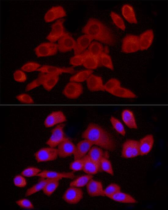 CaMKK2 Antibody