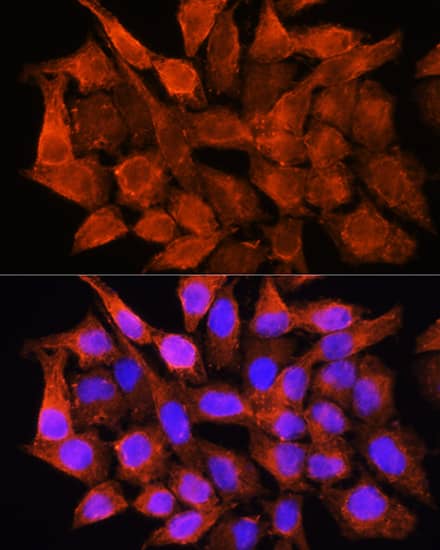 Aminomethyltransferase Antibody