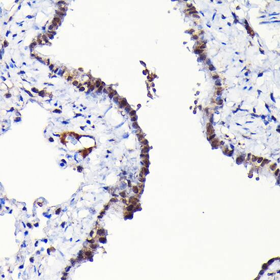 RGS14 Antibody