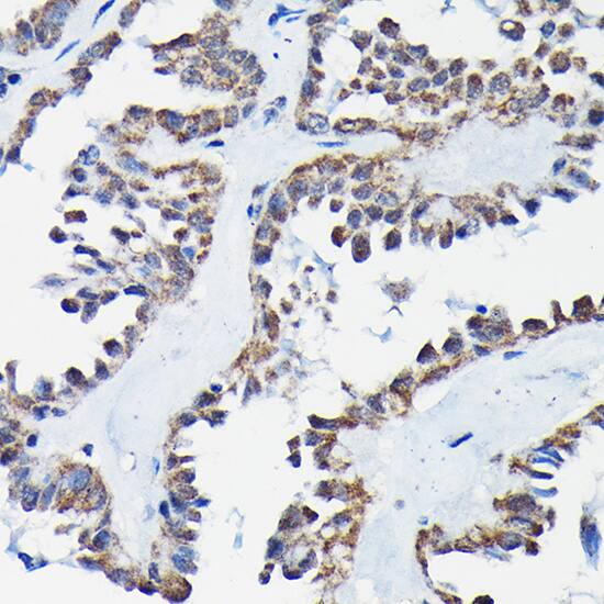 RGS14 Antibody