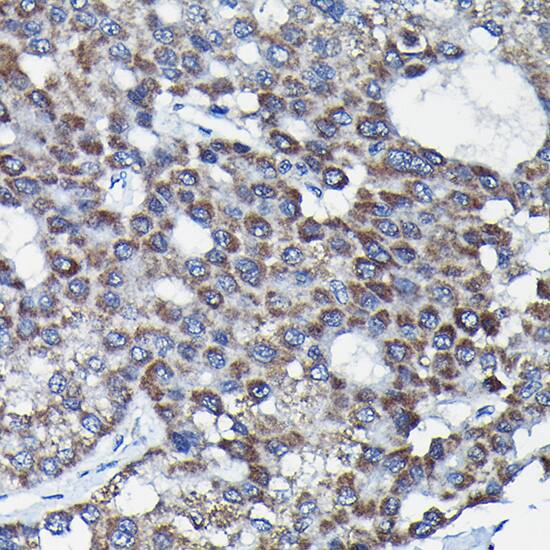 RGS14 Antibody