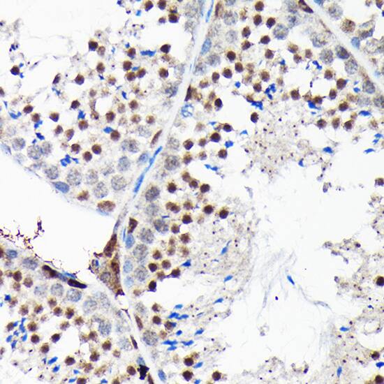 RGS14 Antibody