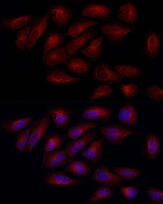 alpha Tubulin 4a Antibody