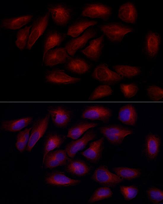 alpha Tubulin 4a Antibody
