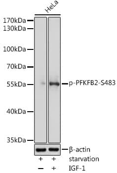 PFKFB2 [p Ser483] Antibody