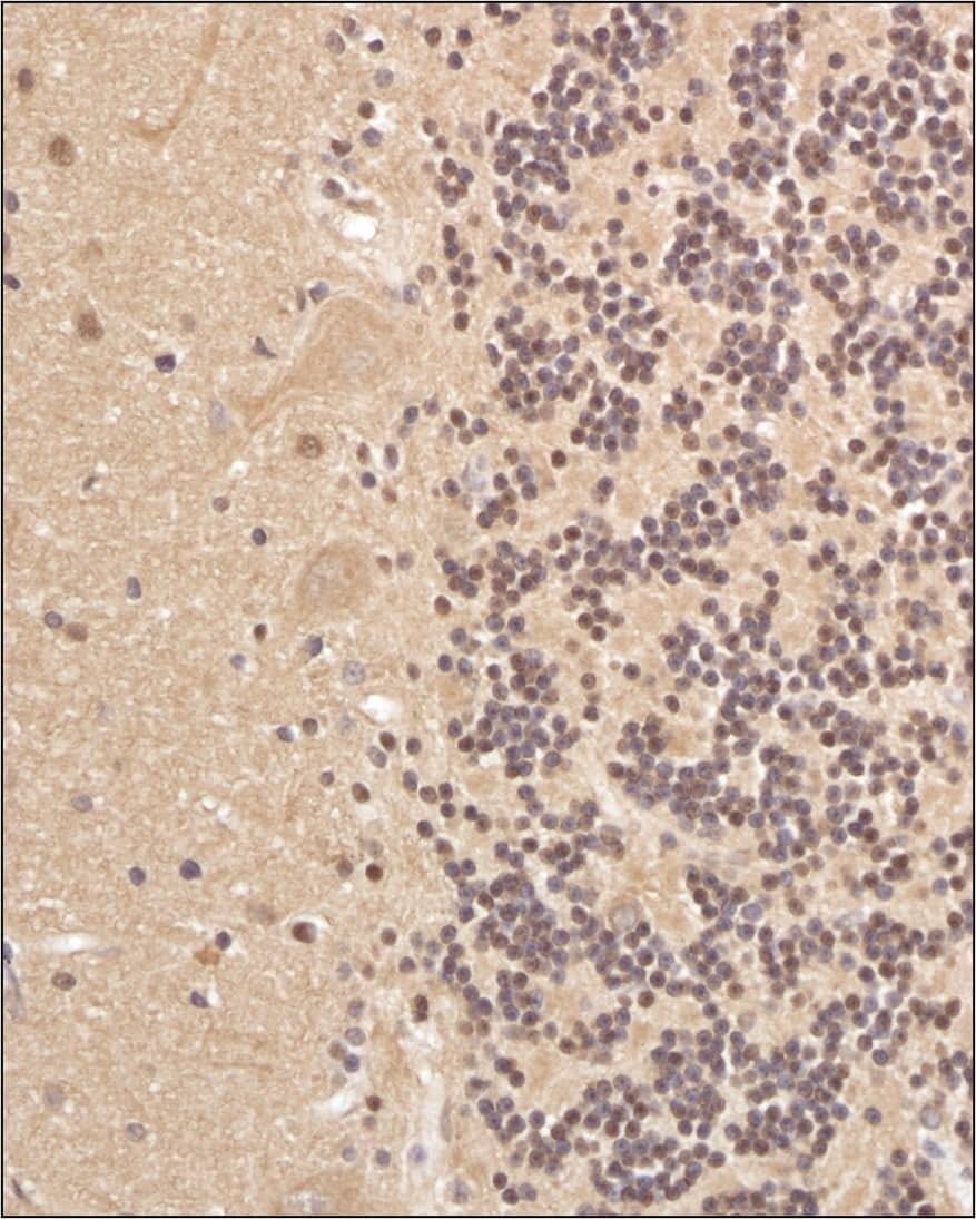 alpha Tubulin Antibody (DM1AR) Immunohistochemical Staining of alpha Tubulin in Human Brain