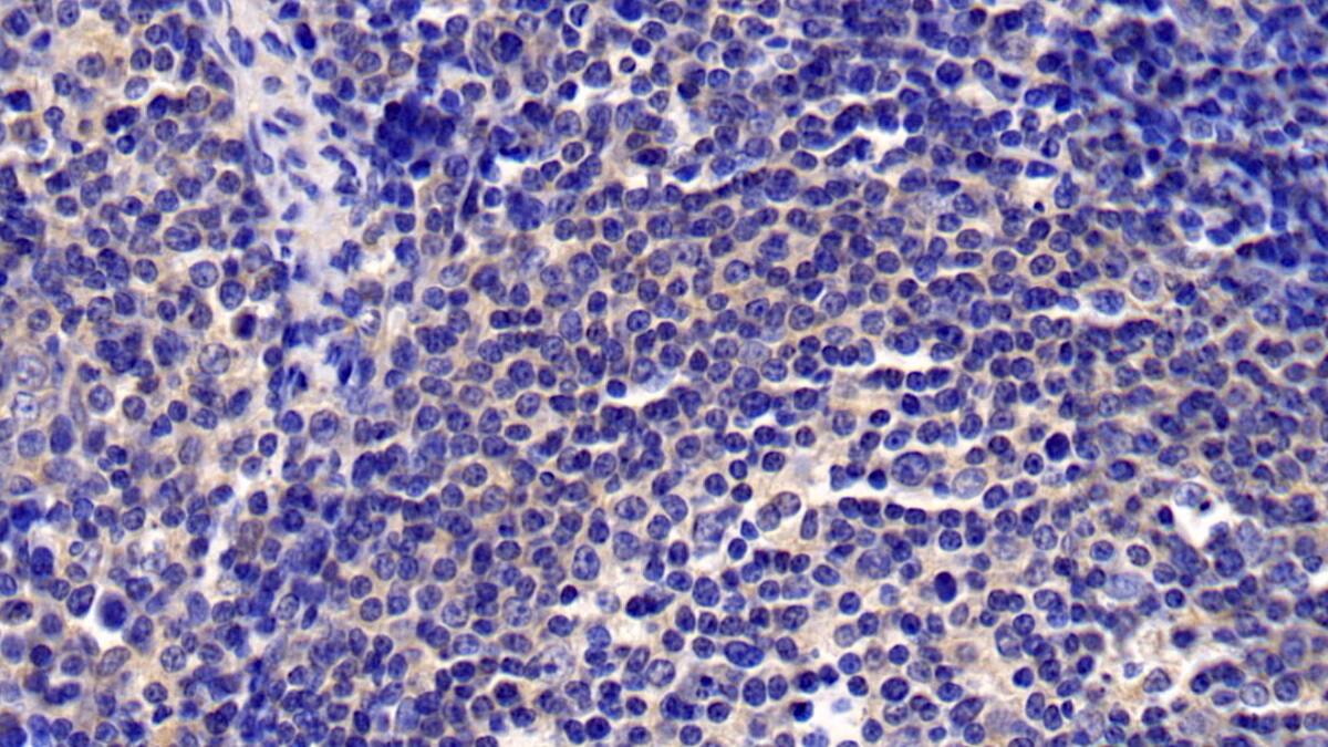 CXCL16 Antibody (C1)