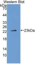 IL-37/IL-1F7 Antibody (1#)