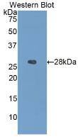 IGFBP-4 Antibody (A3)