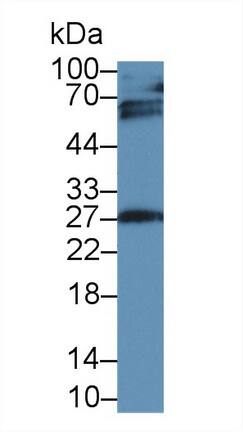 IGFBP-4 Antibody (A4)